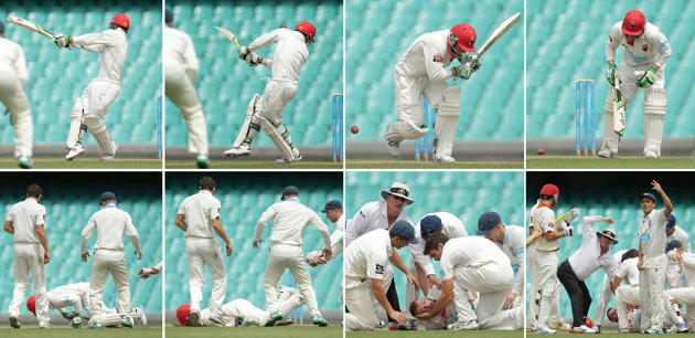 Phillip Hughes died due to sports accident